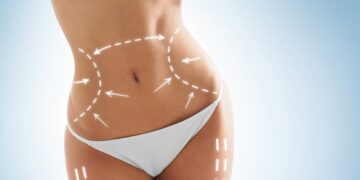 skin treatments 1