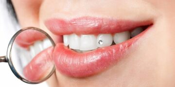 tooth gems