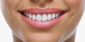 white teeth 1