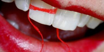 flossing