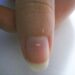 nails white spots