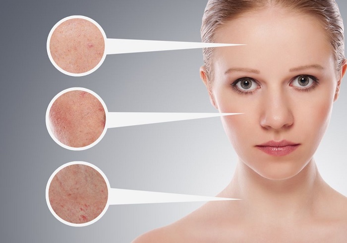 skin problems that can be treated with a skin infusion treatment
