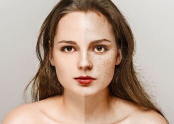 3 freckles woman