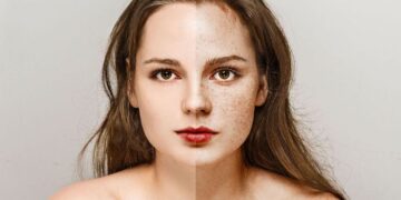 3 freckles woman