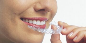 Invisalign