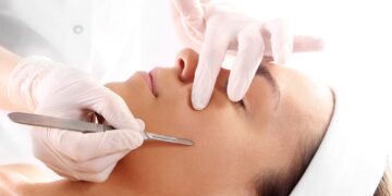 dermaplaning is the latest method to get smooth perfectly exfoliated skin 1170x780