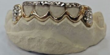 Teeth e1501831096583