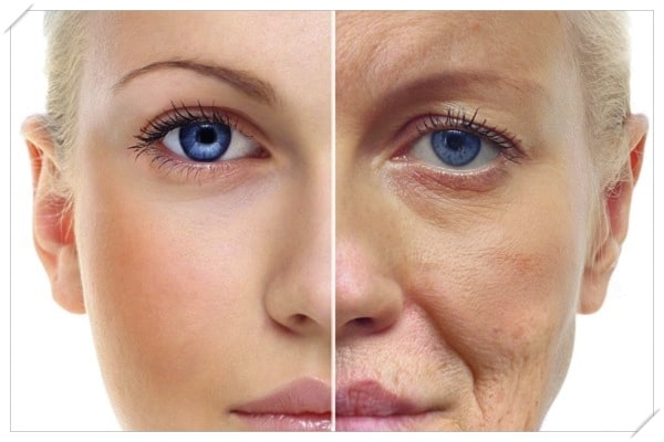 what is microneedling aging skin
