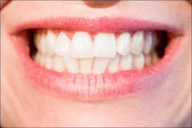 Close up of a woman's smile with perfect white teeth