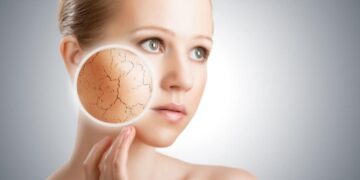natural beauty tips dry skin