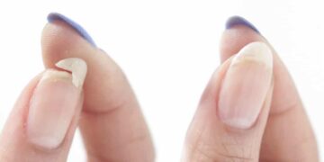 how to have healthy nails