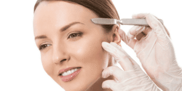 Dermaplaning