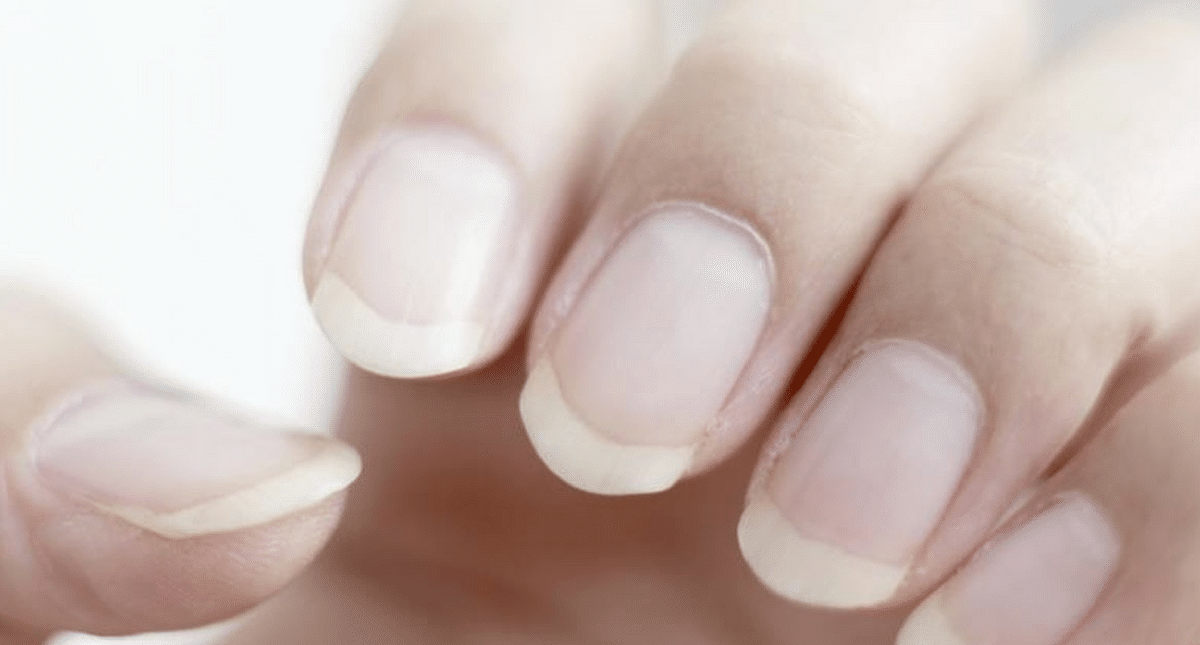 Weak and Splitting Nails Treatment Plan That Won’t Cost a Fortune