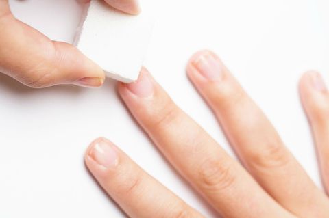 white spots on nails, nail bed, types of nails, splitting nails, flat fingernails, what causes brittle nails, nail disorders, nail discoloration, different types of nails, damaged nail bed, nail vitamin deficiency, vertical nail ridges, vertical ridges in nails, what causes vertical ridges in nails, vertical ridges on nails vitamin deficiency, vertical ridged nails, nail vitamin deficiency