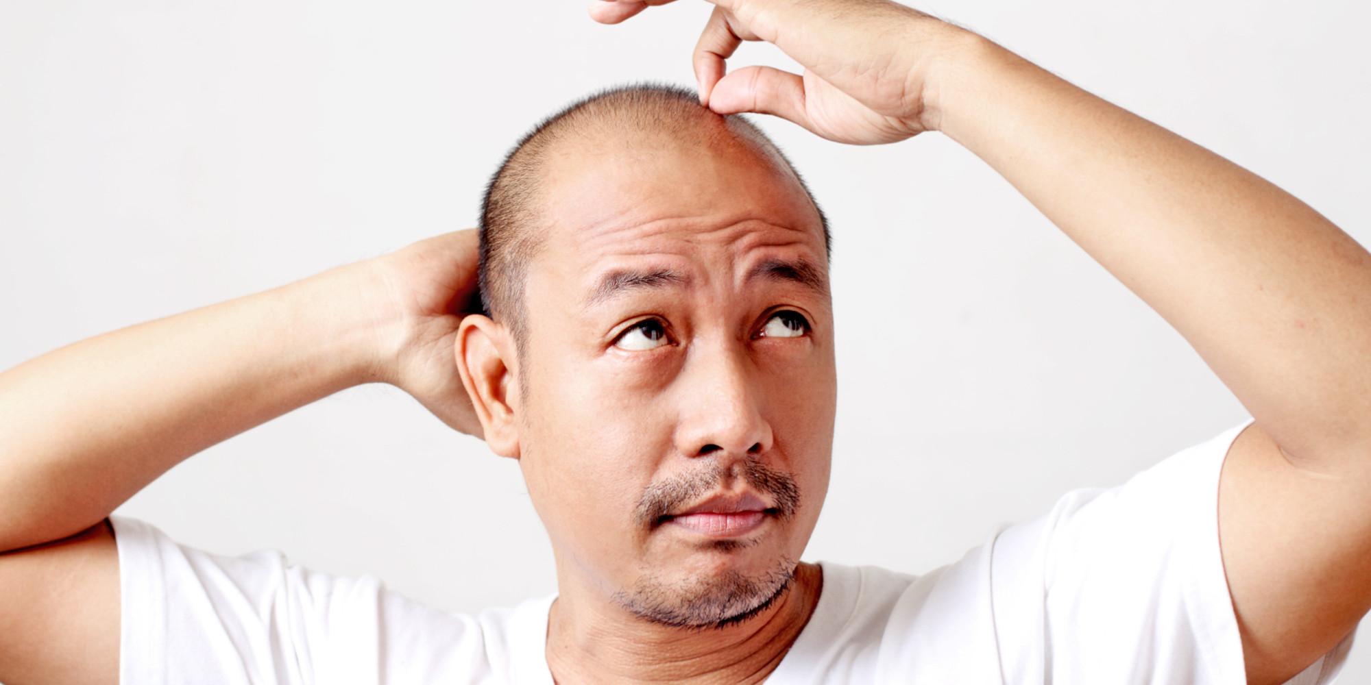 6 Awesome Treatments To Promote and Restore Hair Growth In Men