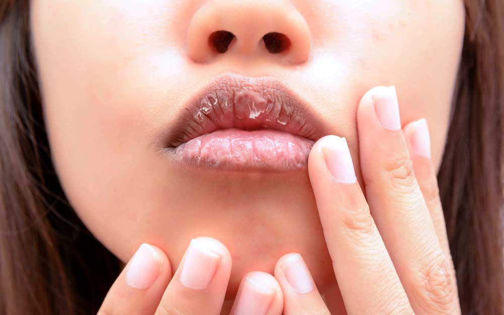 Secondary keywords: dry patch on lip, why are my lips always chapped, home remedies for chapped lips, chapped lips cure, how to get soft lips, chapped skin, best chapstick for dry lips, best lip treatment, lips peeling, how to get rid of chapped lips fast, best thing for chapped lips, lip balm vs chapstick, best moisturizing lip balm, how to moisturize lips, how to treat chapped lips, coconut oil for chapped lips, how to get dead skin off lips, home remedy for chapped lips, best chapsticks, cure for chapped lips, dried lips treatment,