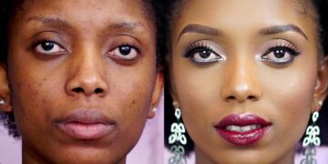 Hide Dark Spots