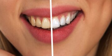 tooth comparison